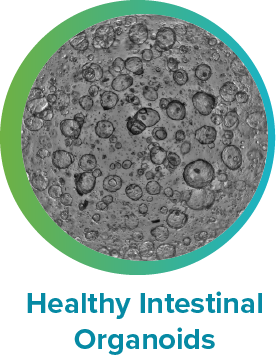 Human Normal Duodenum Organoids