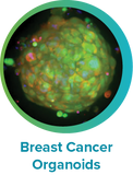 Human Breast Cancer Organoid