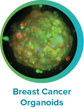 Human Breast Cancer Organoid